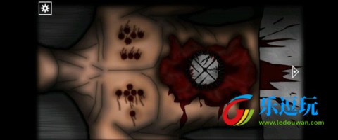 遗忘之丘手术室